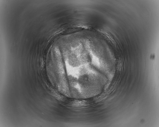 X0000098180569200805151143