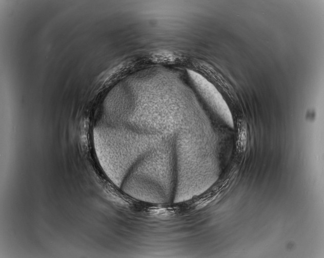 X0000098180616200805151142