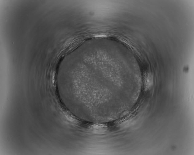 X0000098180619200805151142