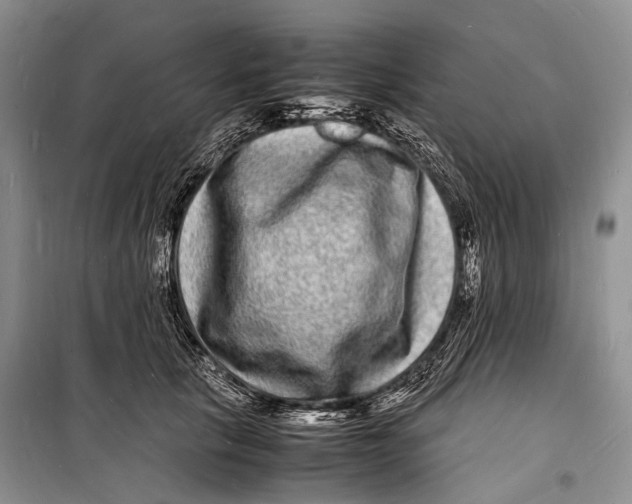 X0000098180657200805151142