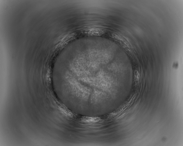 X0000098180663200805151142