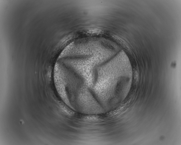 X0000098180668200805151142