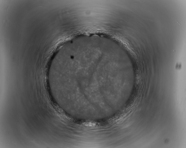 X0000098180687200805151141