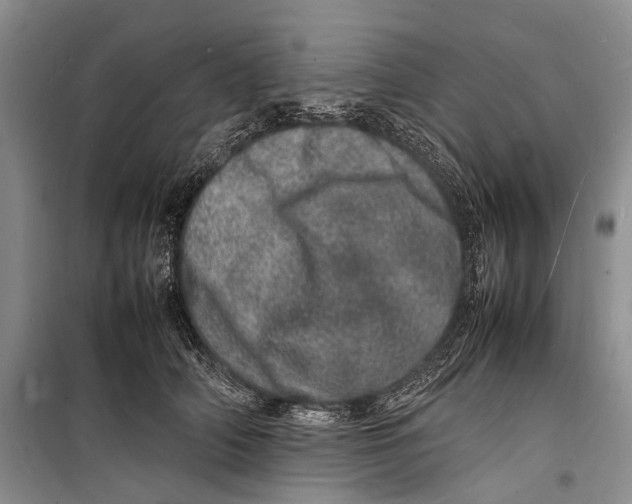 X0000098180706200805151140