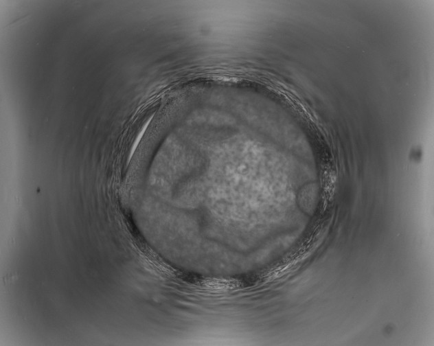 X0000098180707200805151140