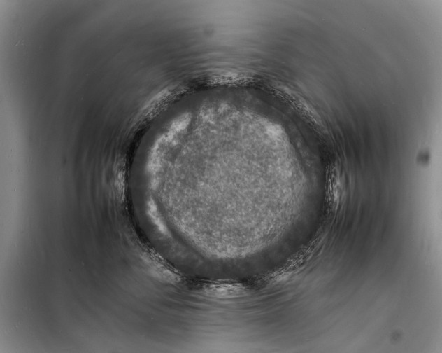 X0000098180716200805151140