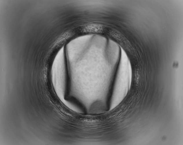 X0000098180735200805151140