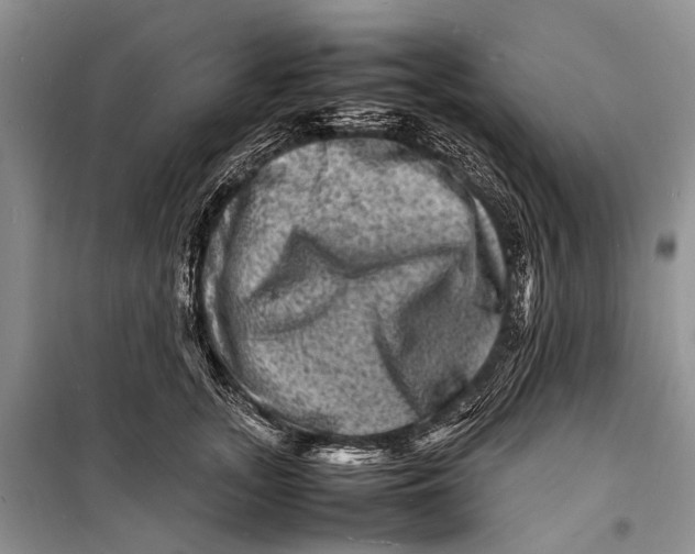 X0000098180755200805151140