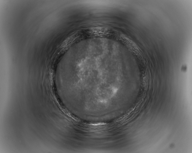 X0000098180757200805151140