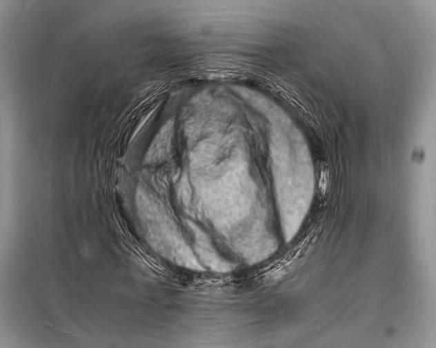 X0000098180771200805151139