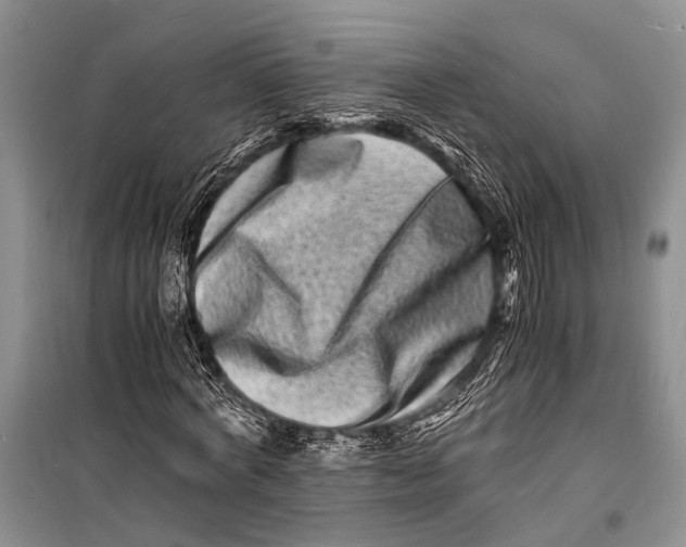 X0000098180772200805151139