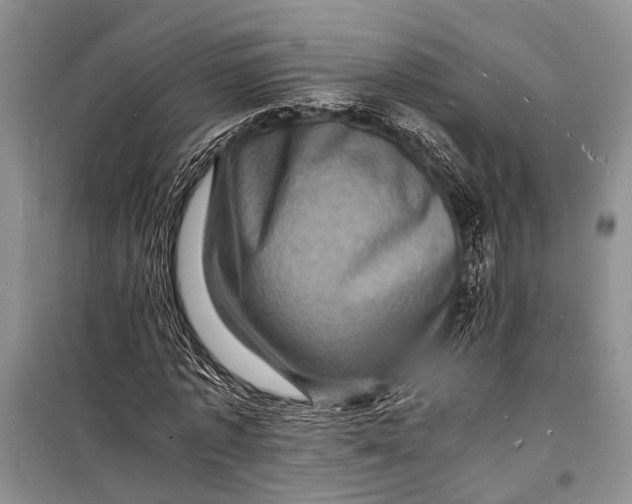 X0000098180773200805151139