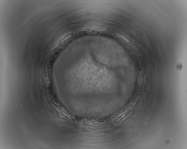 X0000098180774200805151139