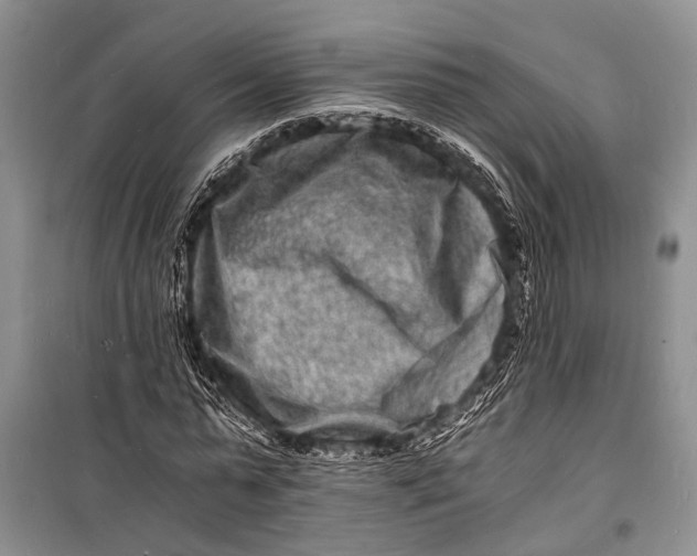 X0000098180775200805151139