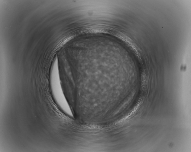 X0000098180785200805151139