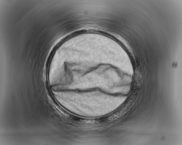 X0000098180791200805151139