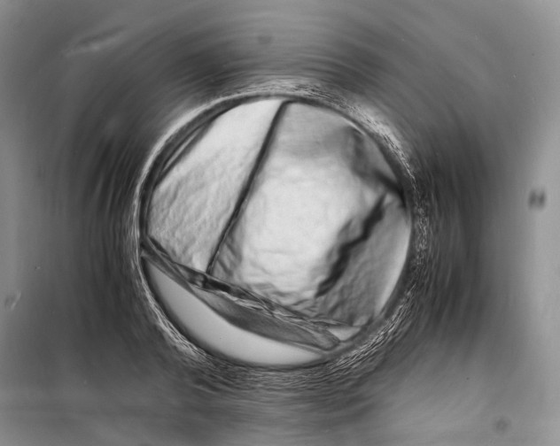 X0000098180792200805151139