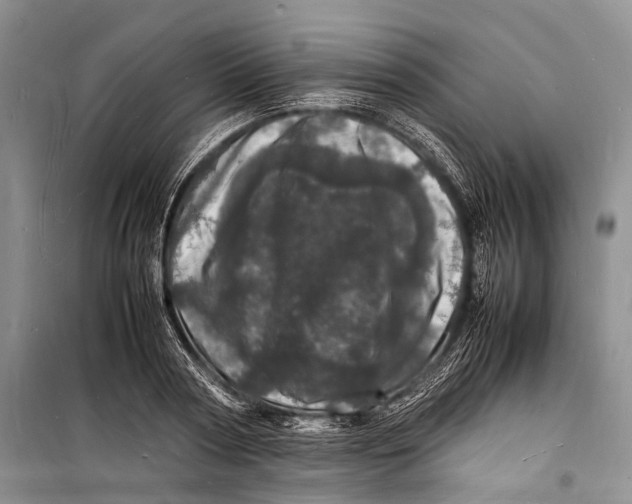 X0000098180794200805151139