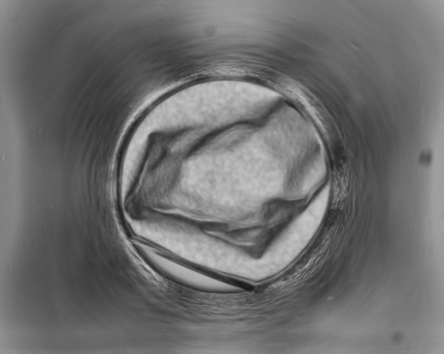 X0000098180795200805151139