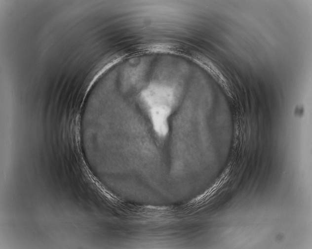 X0000098180798200805151139