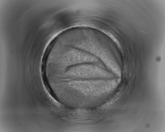 X0000098180799200805151139