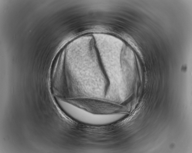 X0000098180845200805151139