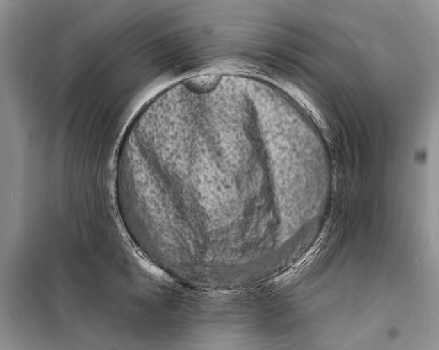 X0000098180854200805151139