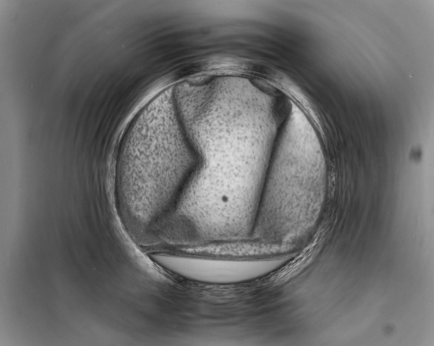 X0000098180859200805151139