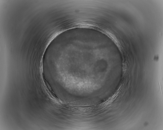 X0000098180891200805151138