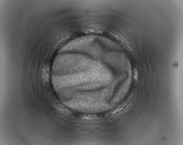 X0000098180915200805151137