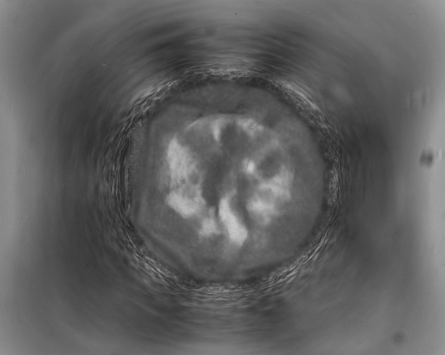 X0000098180917200805151137