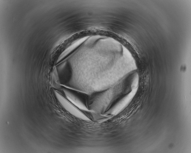 X0000098180919200805151137