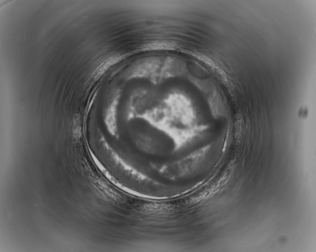 X0000098180929200805151137