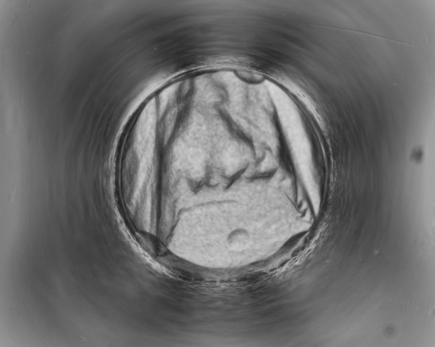 X0000098180949200805151137