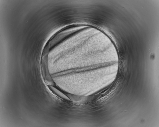 X0000098180951200805151137