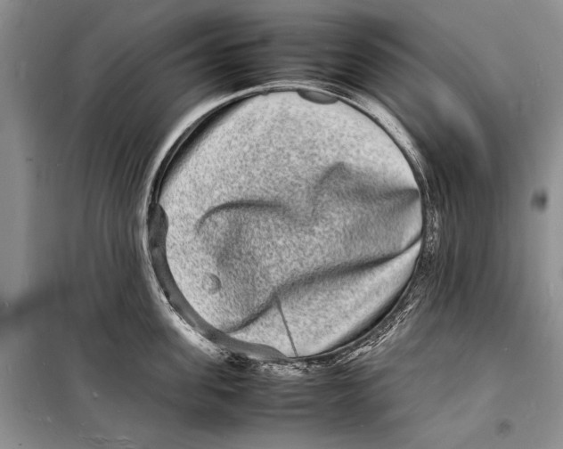 X0000098180955200805151137