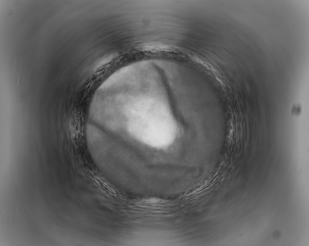 X0000098180966200805151137