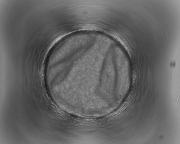 X0000098180975200805151137