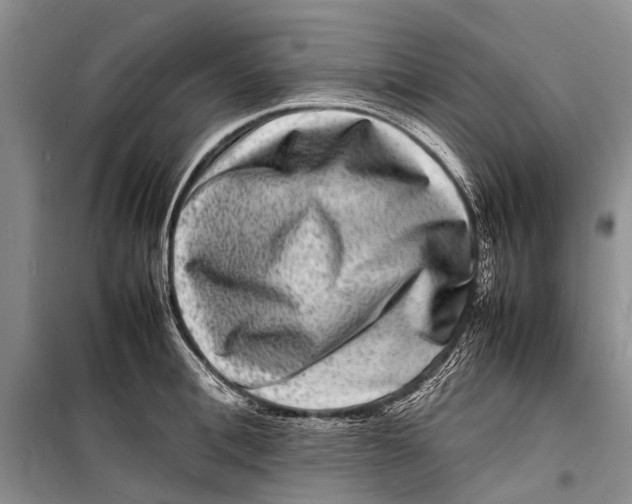 X0000098180996200805151136