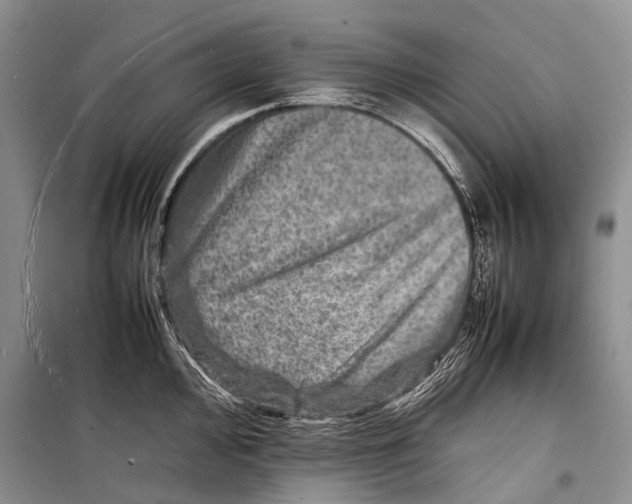 X0000098181000200805151136