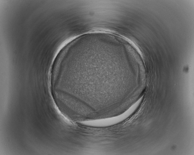 X0000098181003200805151136