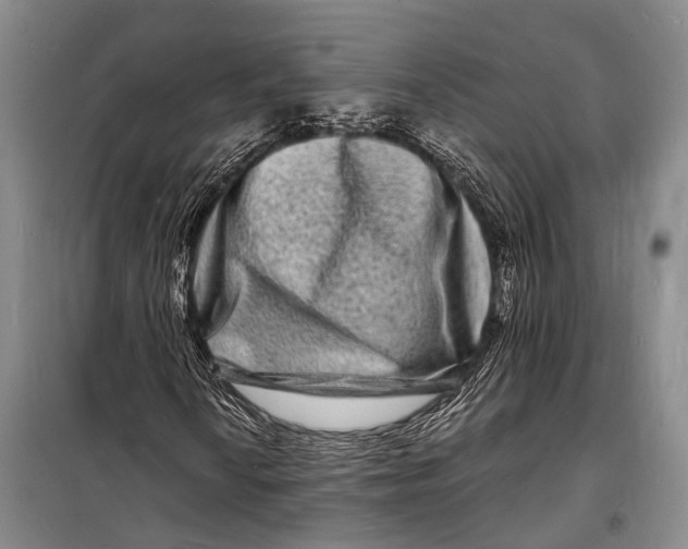 X0000098181010200805151135