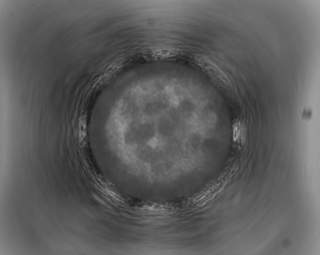 X0000098181011200805151135