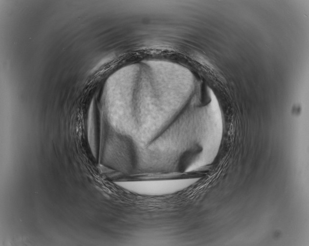 X0000098181014200805151135