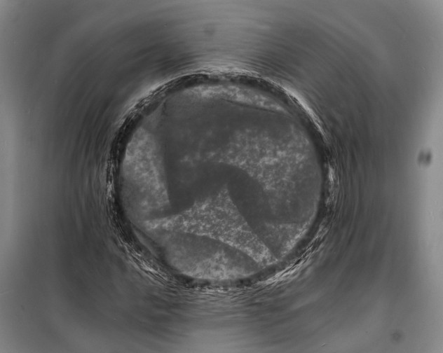 X0000098181016200805151135