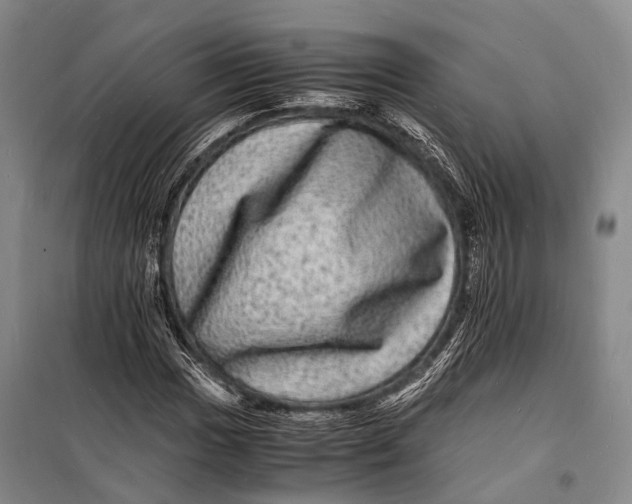 X0000098181017200805151135