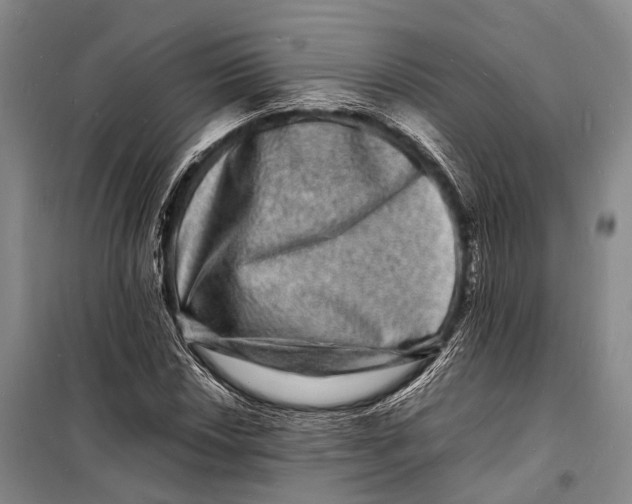 X0000098181018200805151135