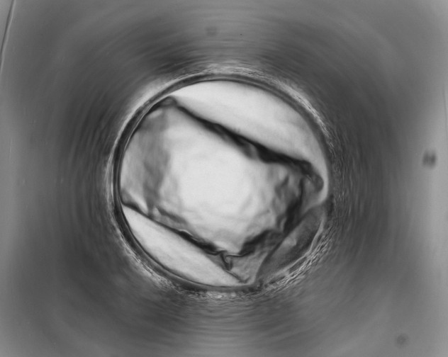 X0000098181032200805151136