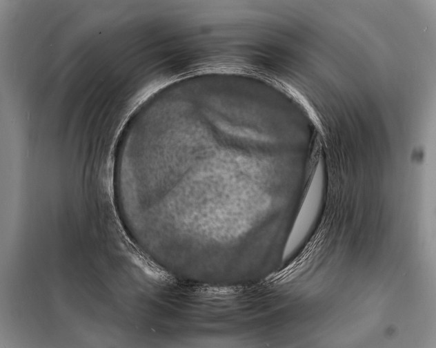 X0000098181035200805151136