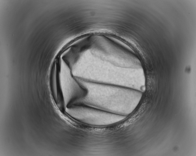 X0000098181038200805151136